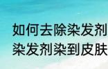 如何去除染发剂染在皮肤上的颜色 被染发剂染到皮肤如何处理